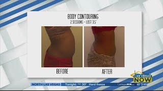Vjazzy Body Contouring