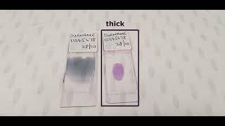 How to make a malaria blood smear