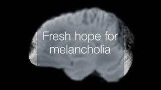 Depression research brings fresh hope for melancholia sufferers