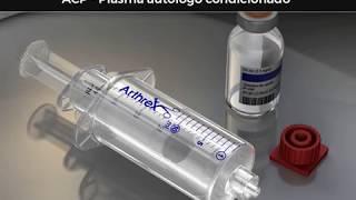 ACP - Plasma autólogo condicionado