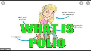 WHAT IS POLIO: EVERYTHING YOU NEED TO KNOW