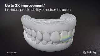 Invisalign® G8 | SmartForce Aligner Activation | Align Technology