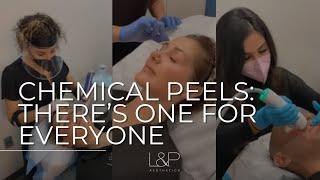 Fall Into Beauty 2022 : Chemical Peels - There's One For Everyone