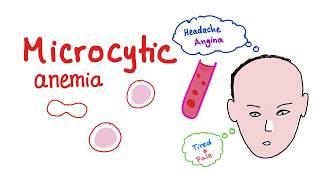 Microcytic Anemia introduction