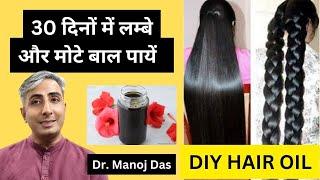 बालों को जल्दी लम्बा और घना कैसे करें। HOW TO GROW HAIR FAST I DR. MANOJ DAS