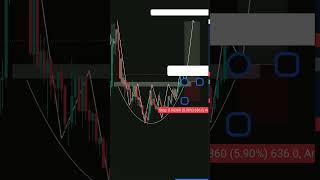 Rounding Bottom Pattern   #trading #forex #crypto #stockmarket #chartpatterns #ufuture #xauusd #btc