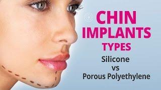 CHIN IMPLANTS TYPES Silicone vs Porous Polyethylene