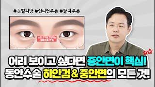 동안외모의 핵심은 중안면 | 하안검&중안면 동안 수술의 모든 것