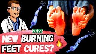 Top 7 Burning Feet Causes & Treatments  [+2 New Cures?]