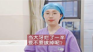 大牙烂了一半要不要拔掉呢？