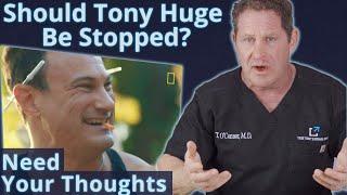 Should Tony Huge Be Stopped? I Want to Know What You Think