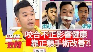 咬合不正影響健康，靠正顎手術改善？！【醫師好辣】20200121 part3 EP883 陳保仁 趙國翔