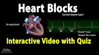 Heart (AV) Blocks - INTERACTIVE Animation with Quiz.