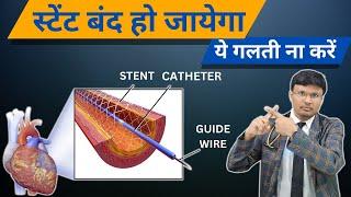 Cardiac stent:-can be damaged by which activities