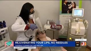 How To Rejuvenate Your Lips Without Needles | Suddenly Slimmer Med Spa Phoenix