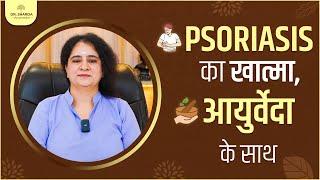 Psoriasis Ayurvedic Treatment - सोरायसिस  का करें  निवारण   | @DrShardaAyurveda