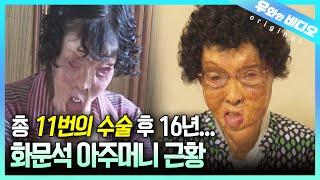 (근황 공개) 화상으로 얼굴과 손이 녹아버린 화문석 아주머니, 16년 후 근황을 전해드립니다┃We Met the Hwamunseok Lady After 16 Years