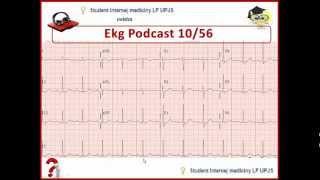 Ekg Podcast 10/56. Kompletný popis Ekg na kazuistike + interpretácia, 1.časť