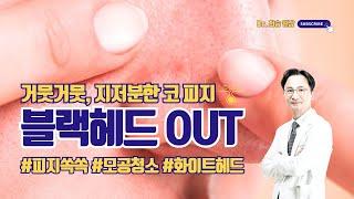 거뭇거뭇, 지저분한 #코피지 #블랙헤드 쉽게 해결하는 방법 #닥터최승 #청담동피부과 #청담노엘의원 #최승원장 #모공 #피지 #코모공