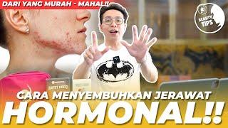 CARA MENYEMBUHKAN JERAWAT HORMONAL DARI YG MURAH SAMPE YG MAHAL! - BEAUTY TIPS