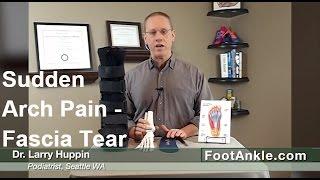 Sudden Severe Arch Pain With Seattle Foot Doctor Larry Huppin