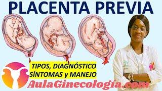 PLACENTA PREVIA: CLASIFICACIÓN, DIAGNÓSTICO, 🩸SÍNTOMAS🩸, MANEJO... - Ginecología y Obstetricia -