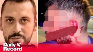 Gangster who sparked Scotland's violent drug war pictured after brutal revenge slashing