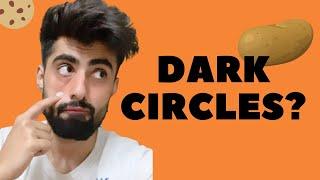 आँखों के काले घेरे जड़ से ख़त्म करें, Remove Dark Circles Permanently || Mridul Madhok