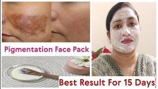 Pigmentation Removal Face Pack | Home Remedies | Effective Results | Nida Naseer  | 2024 