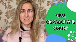 Чем обрабатывать ожоги у детей