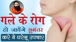 गले के रोग हो जायेंगे छूमंतर करे ये घरेलू उपचार | Swami Ramdev