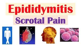 Epididymitis (Scrotal Pain) | Causes, Risk Factors, Signs & Symptoms, Diagnosis, Treatment