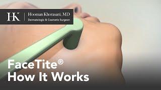 FaceTite Skin Tightening How It Works | Offered by Dr. Hooman Khorasani