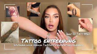 Letztes Tattoo Entfernung Update 22 Tattoos entfernt ! ES IST ALLES WEG! + vorher / nachher Bilder