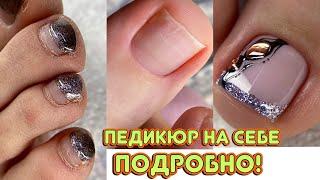 Мои страшные ножки  Педикюр на себе / Френч на ногах / Дизайн с фольгой