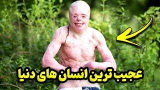 عجیب ترین انسان های دنیا که باور نمیکنید وجود داشته باشن!