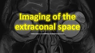 Imaging of the extraconal space