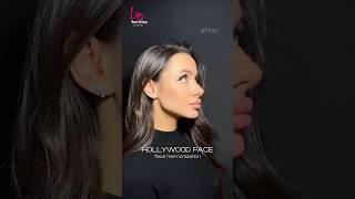 Face harmonization #recommended #рек #top #beauty #aesthetic #lifting #lips #botox #skincare