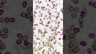 Mushroom spores through a HIGH POWERED MICROSCOPE!