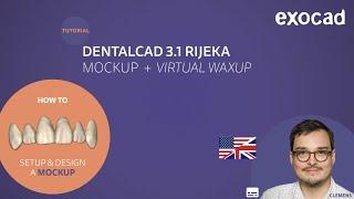 DentalCAD 3.1 Rijeka, Mockup + Virtual Waxup video tutorial