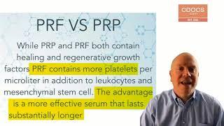 Tip of the Day: Introduction to PRF