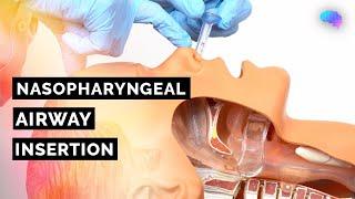 Nasopharyngeal Airway (NPA) Insertion | ABCDE Emergency | OSCE Guide | UKMLA | CPSA