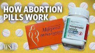 Medical Abortions: The Science Behind How Abortion Pills Work