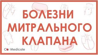 Болезни митрального клапана. Пролапс митрального клапана, стеноз, регургитация.