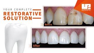 Your Complete Restorative Solution | Ultradent Products