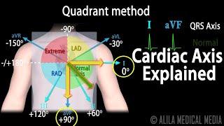 Cardiac Axis Interpretation, Animation.