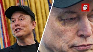 Elon Musk reveals who punched him in the face, leaving him with a shiner