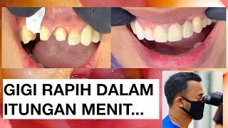 Gigi Rapih Dalam Itungan Menit... | Temporary | Dokter Gigi Griya RR