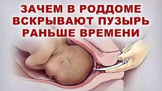 Когда вскрытие плодного пузыря опасно для родов? Зачем вскрывают плодный пузырь раньше времени?