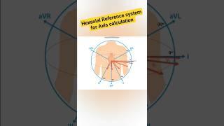 Hexaxial Reference system for Axis calculation #ecg